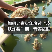 如何让青少年度过“皮肤炸裂”期:青春皮肤护理的秘密(图2) 如何让青少年度过“皮肤炸裂”期:青春皮肤护理的秘密(图2)