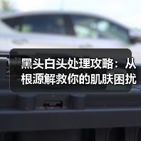 黑头白头处理攻略：从根源解救你的肌肤困扰